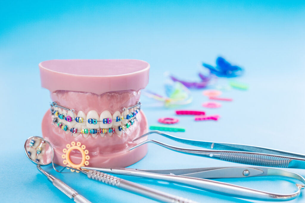 จัดฟันโลหะ braces