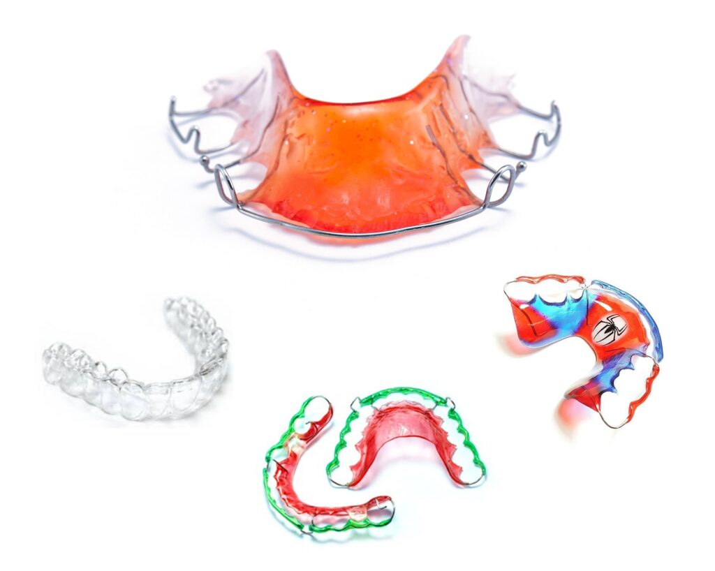 รีเทนเนอร์ retainer